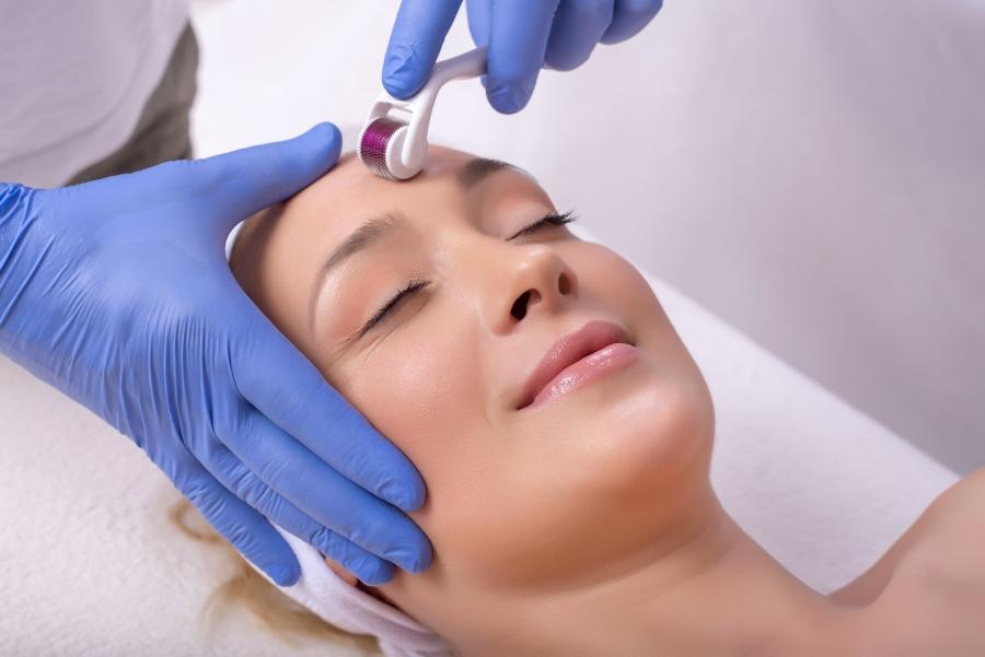 microneedling-behandlung-ablauf