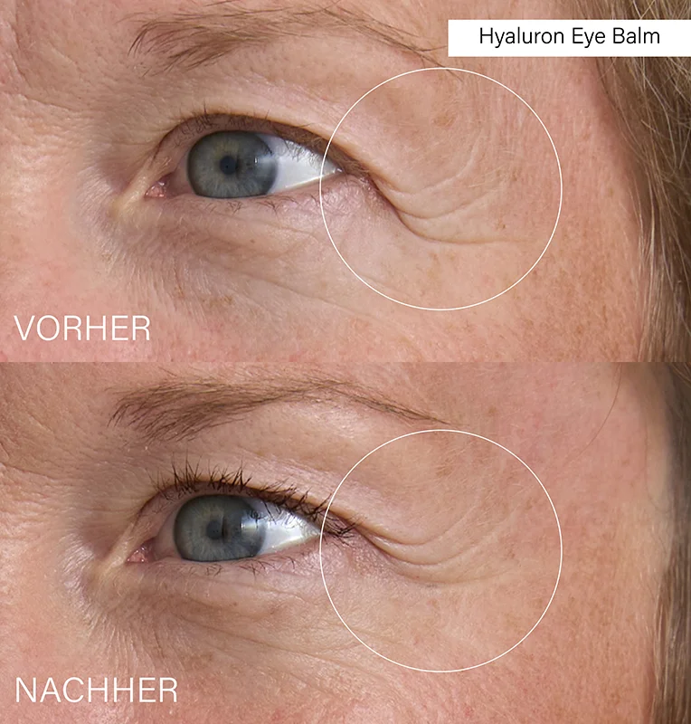 Hyaluron Eye Balm, 15ml