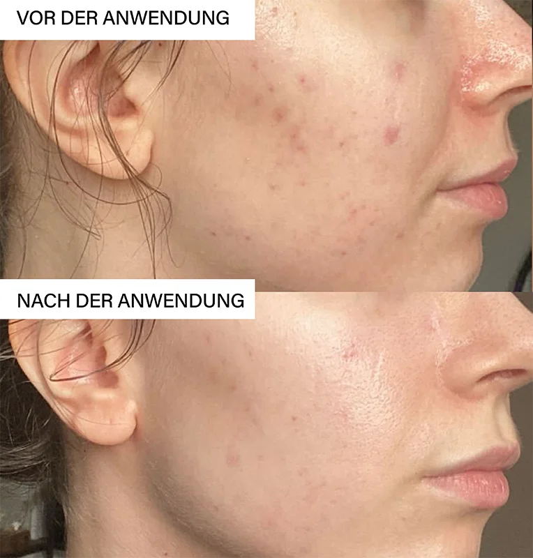 LED Face Mask, 1 Stück