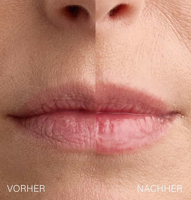 Lip Plumper, 15ml