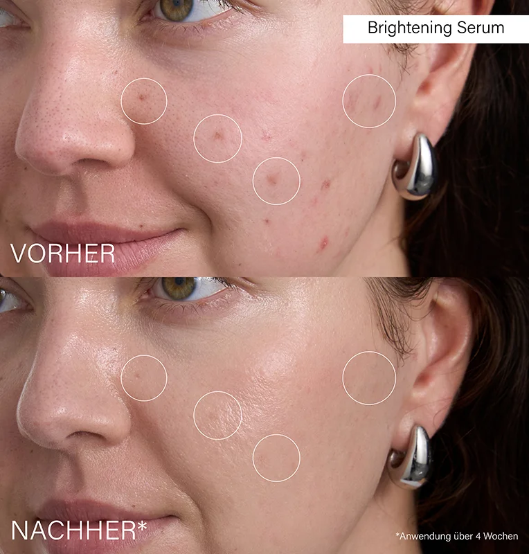 Brightening Serum, 30ml