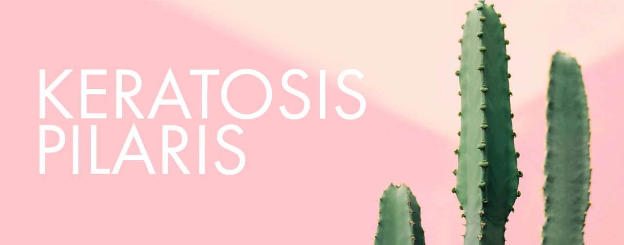 Keratosis Pilaris