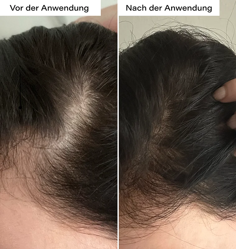 Hair Growth Serum, 100ml
