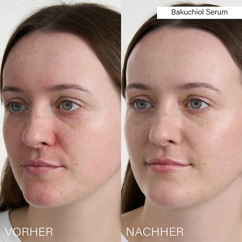 Bakuchiol Serum, 30ml