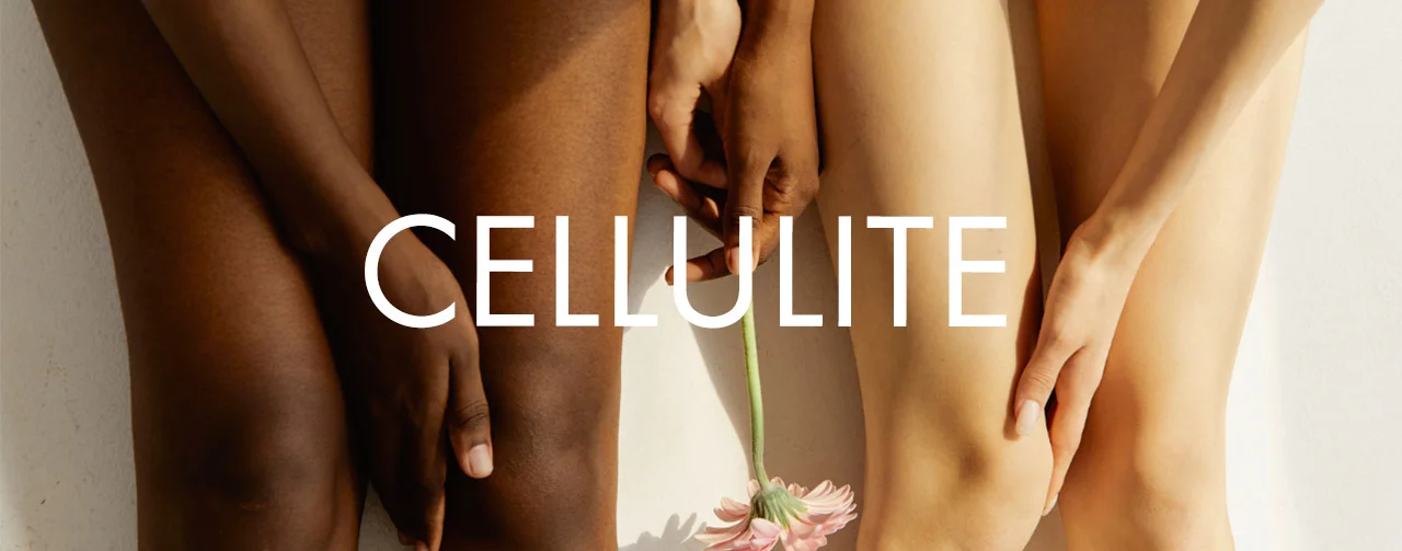 Cellulite Kategorie